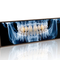 Dental X Ray Close Up