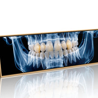 Dental X Ray Close Up